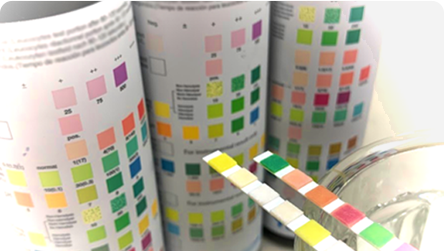 UriScan urine test strips beside their vials and color charts
